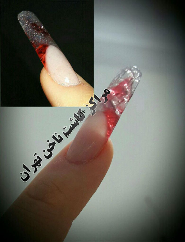 کاشت ناخن شیشه ایی